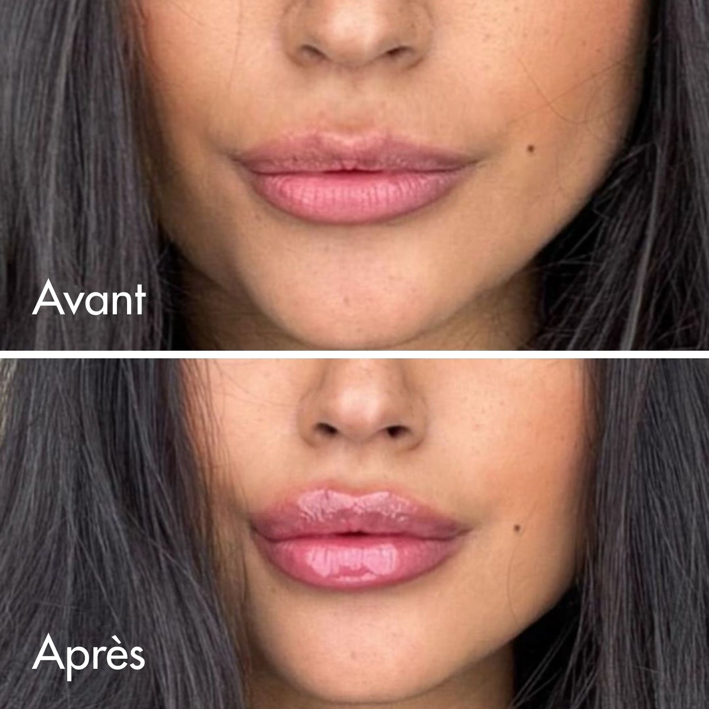 Soin Repulpeur Lèvres
